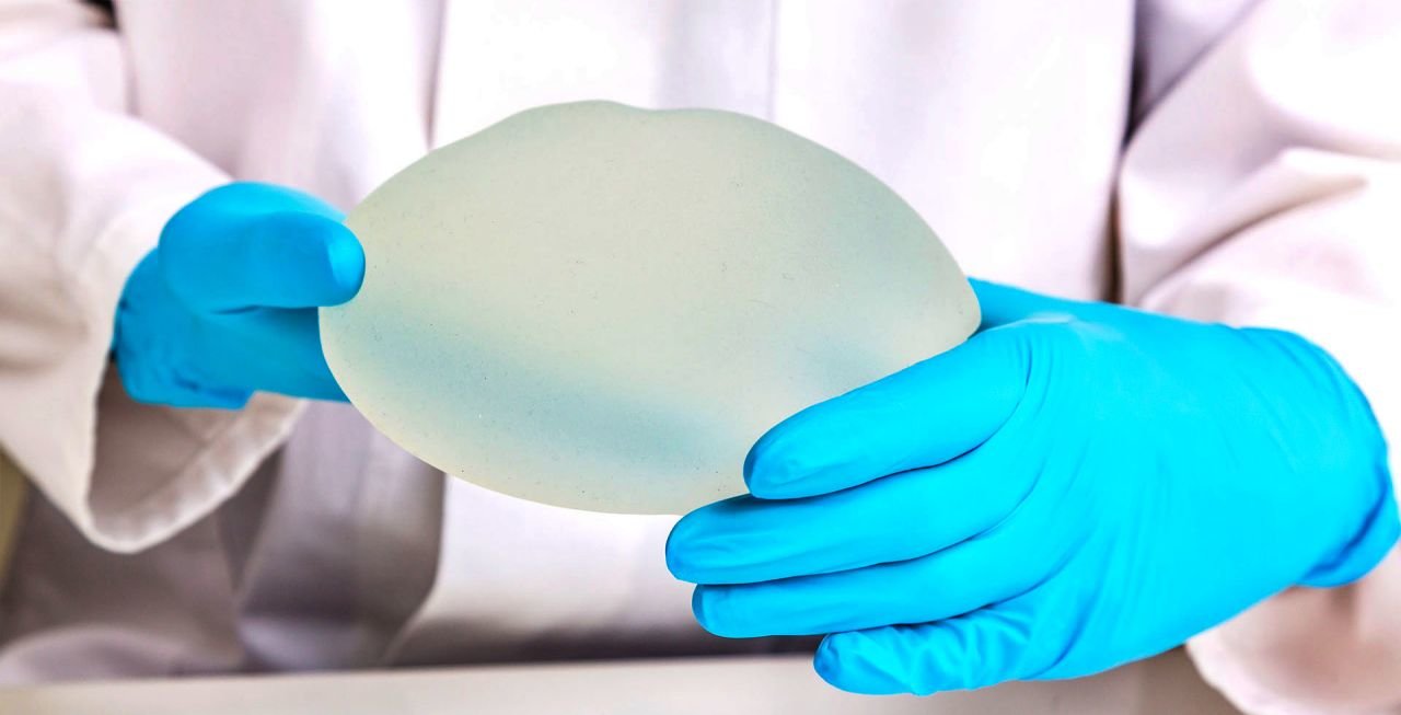 Allergan, anunció en julio del 2019 la retirada voluntaria a nivel mundial de los implantes mamarios texturizados “Biocell” y de los expansores de tejido (Shutterstock)