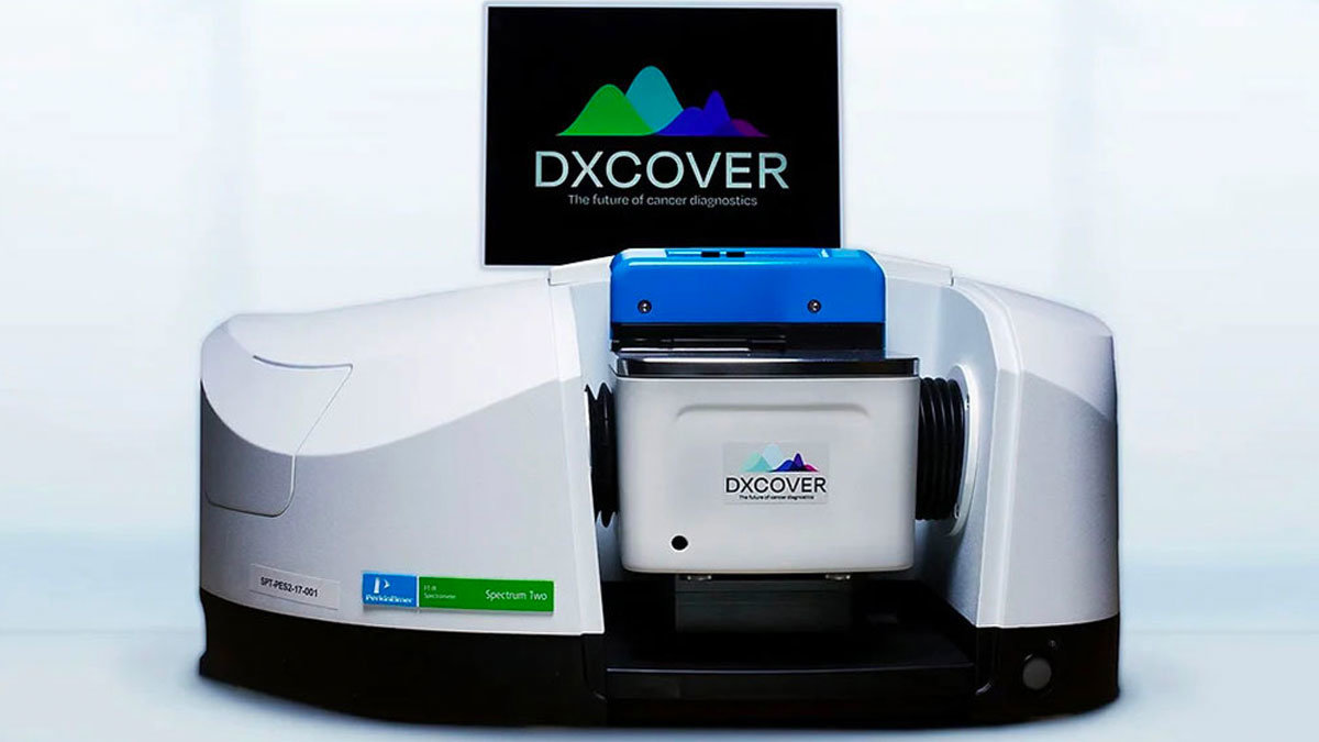 DXCOVER es una máquina que detecta en un 81% de fiabilidad el cáncer cerebral a través de la sangre