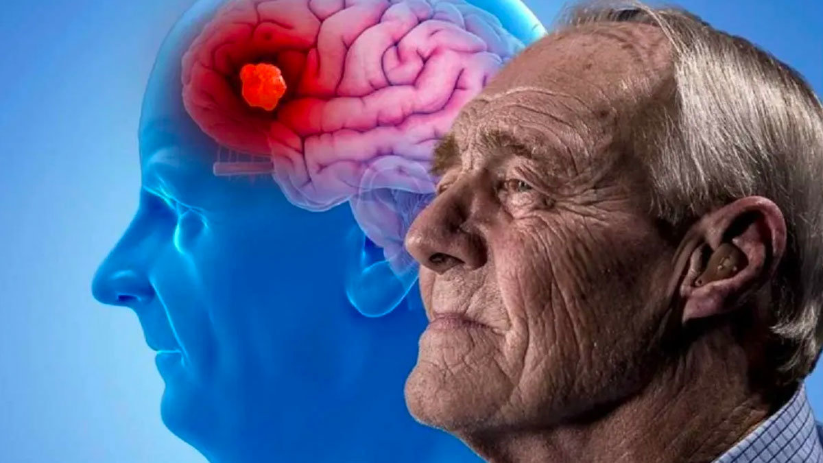 Científicos españoles descubren una nueva forma de detectar el Alzheimer