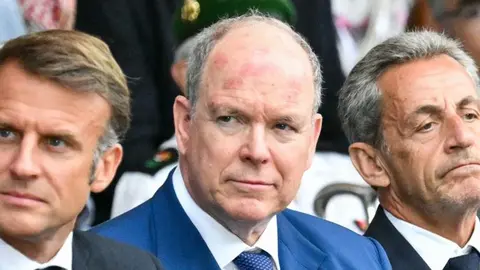 Las manchas en la frente de Alberto de M&oacute;nica disparan los rumores sobre su salud