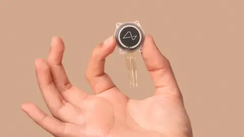 La empresa de biotecnolog&iacute;a de Elon Musk busca solucionar problemas de salud para la poblaci&oacute;n | Imagen: Neuralink