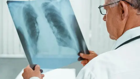 Un m&eacute;dico revisa una radiograf&iacute;a de los pulmones | Imagen: depositphotos.com
