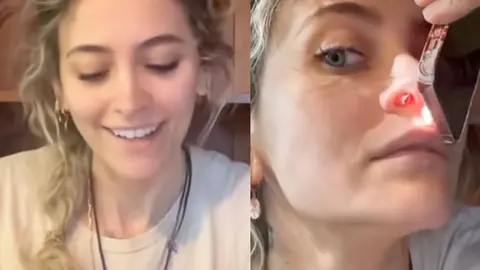 Paris jackson ense&ntilde;a su tabique nasal perforado por esnifar drogas | Tiktok