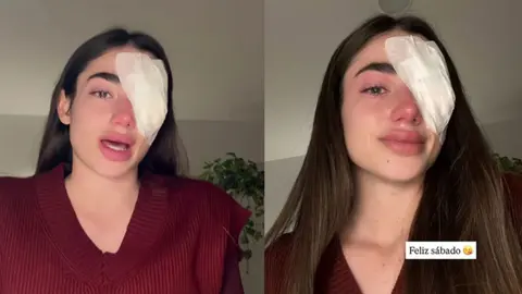 Lola Lolita, afectada por su operaci&oacute;n en el ojo derecho | Instagram