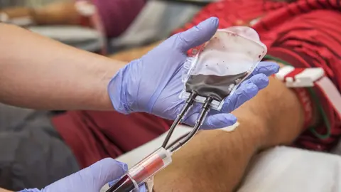 Donar m&eacute;dula tambi&eacute;n es muy importante | CAM