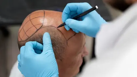 La tecnolog&iacute;a m&aacute;s avanzada en CapilCliniic