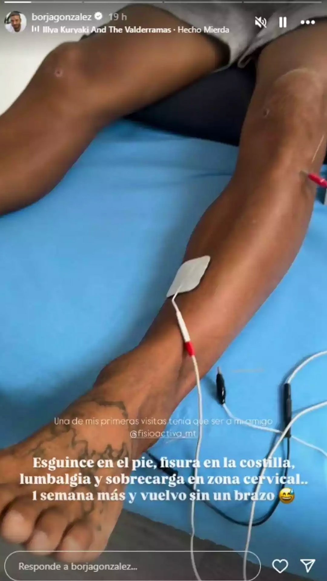 Borja González comparte su tratamiento fisioterapéutico tras Supervivientes | Instagram
